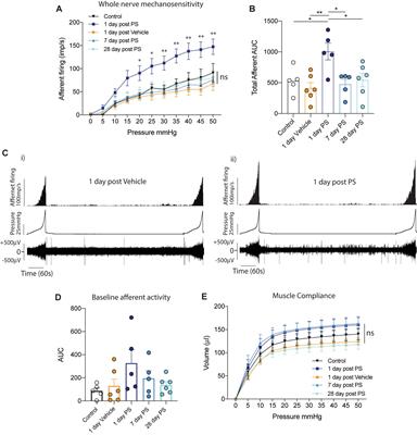 Experimentally Induced Bladder Permeability Evokes Bladder Afferent Hypersensitivity in the Absence of Inflammation